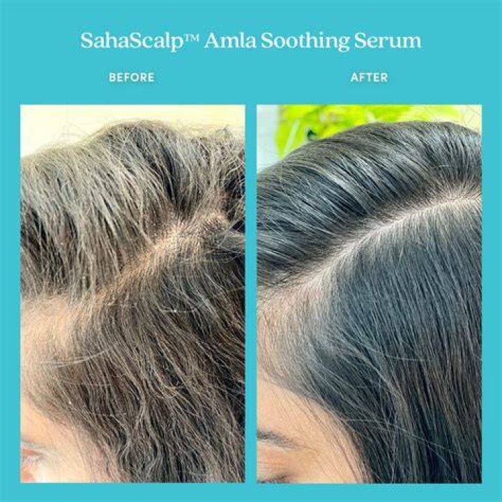 SahaScalp Amla Soothing Scalp Serum